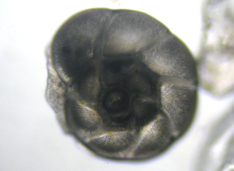 Microfossili o microconchiglie?